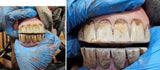 Equine Dentistry